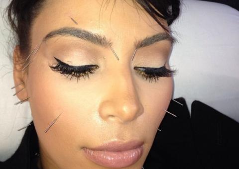  Kim Kardashian posta foto do rosto cheio de agulhas