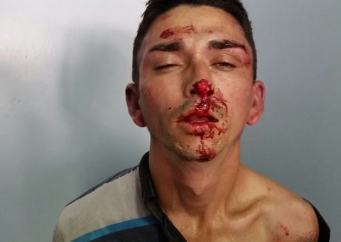 Bandido foge da Polícia, cai e quebra a cara