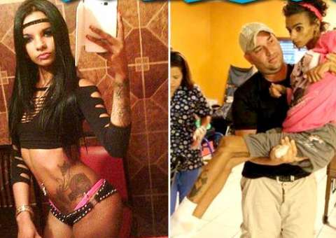 Jovem fez cirurgia para ter seios maiores e ficou com danos cerebrais