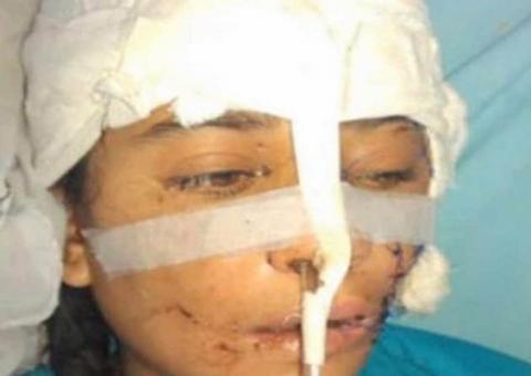 Menina leva machadadas do irmão