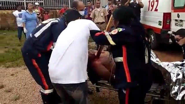 Homem sofre acidente de trabalho e tem peito perfurado por um pedaço de madeira