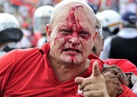 Confronto entre PM e manifestantes no Congresso deixa 8 feridos e 4 detidos