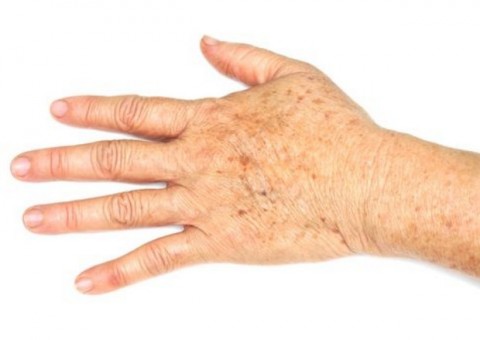  Apenas uma gota de óleo essencial para eliminar as manchas da pele