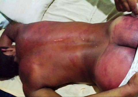  Família acusa PM de ter prendido sem justa causa  e espancado rapaz