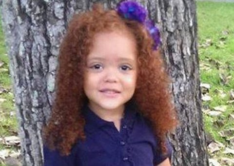 Filha tem o rosto desfigurado por colega na escola e mãe posta no Facebook sua revolta