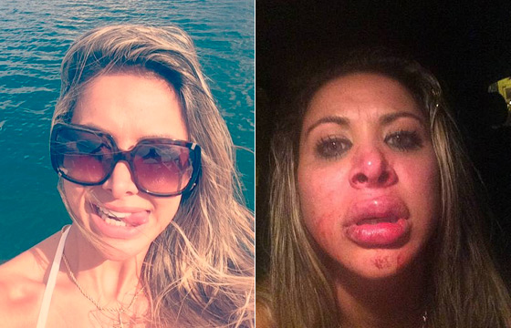 Miss Bumbum Juliana Guerin sofre agressão e desabafa sobre caso