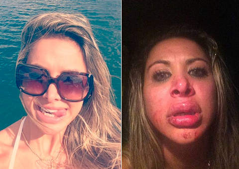 Miss Bumbum Juliana Guerin sofre agressão e desabafa sobre caso