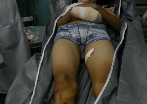 Adolescente de 17 recebe polícia à bala e morre na troca de tiros