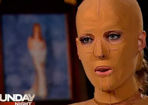 Australiana tem rosto desfigurado por ataque de ciúme 