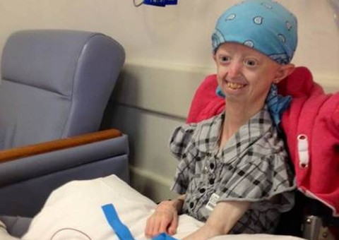  'Adolescente com 100 anos de idade' morre aos 17