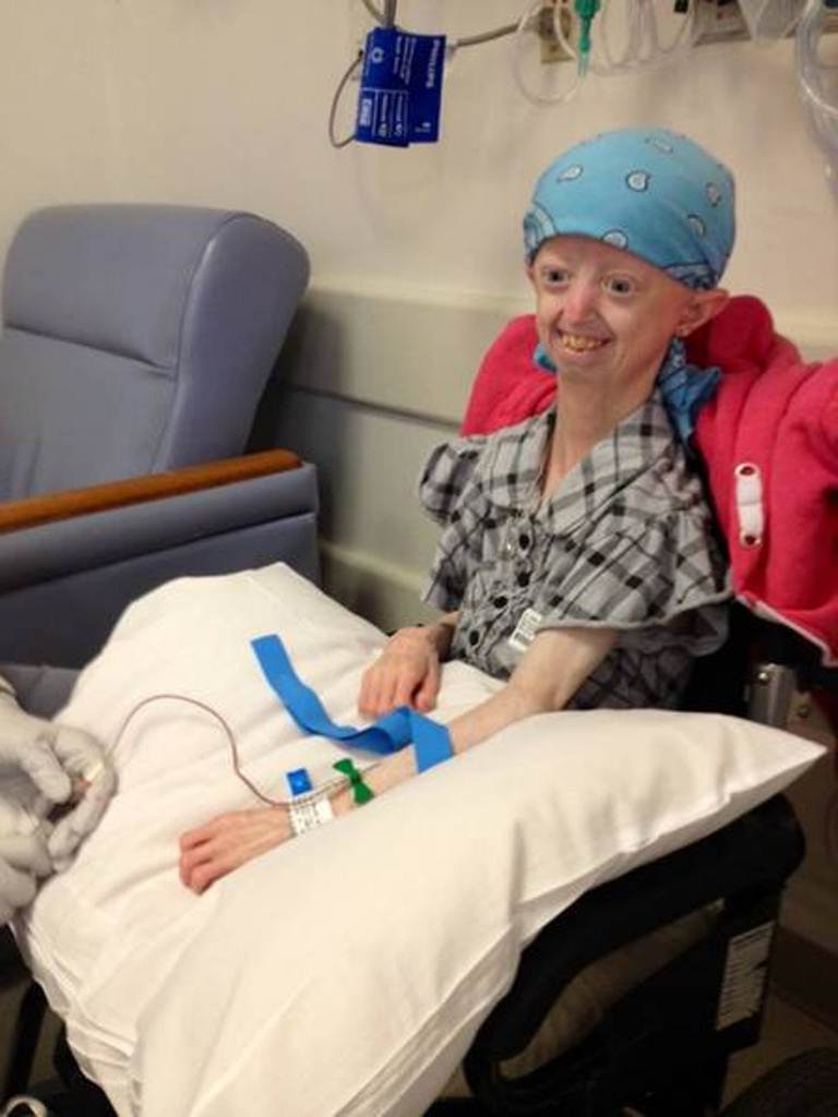  'Adolescente com 100 anos de idade' morre aos 17