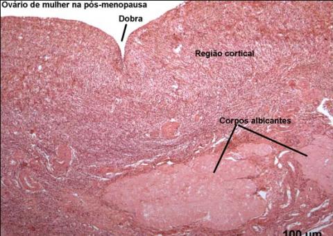 Estudo culpa homens pela menopausa