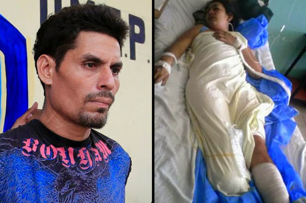 Crueldade: marido desconfia de traição da esposa e corta os dois pés dela com facão