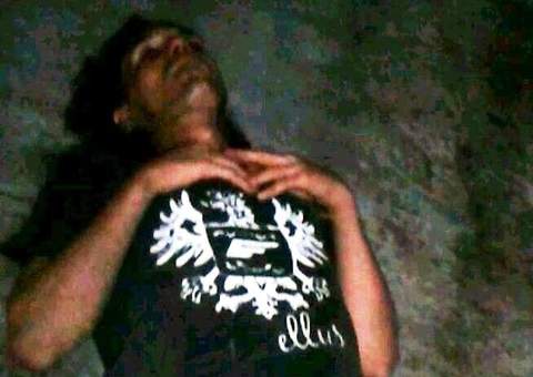 Paciente é flagrado roubando pertences de enfermeira em Rondônia