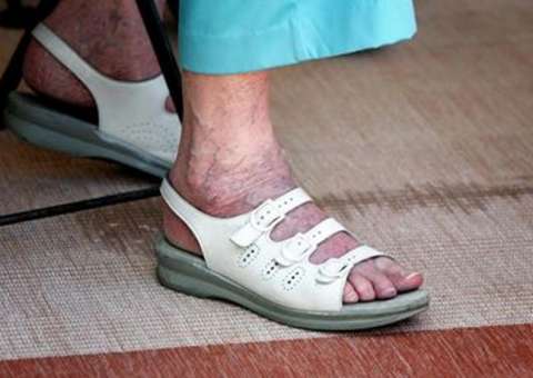 Homem "tarado por chulé",  foi preso por cheirar e lamber o pé de uma idosa