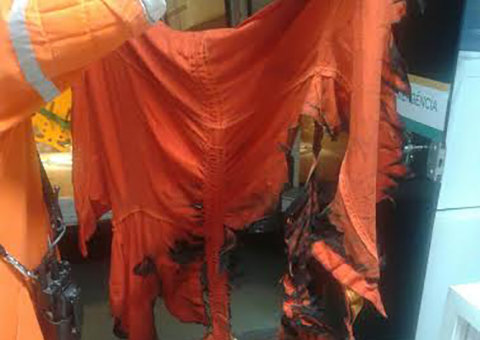 Explosão na refinaria de Manaus deixa trabalhador com 75% do corpo queimado