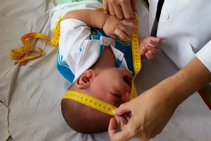 Governo começa a pagar hoje indenização para famílias de crianças com Zika