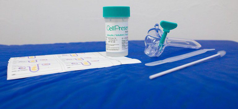 Saúde implementa teste de DNA-HPV no combate ao câncer de colo de útero