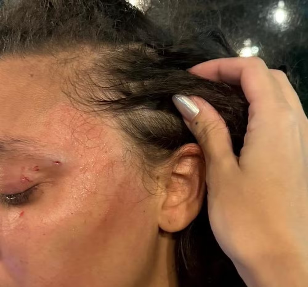 Mulher é agredida ao ser confundida com trans em banheiro de restaurante