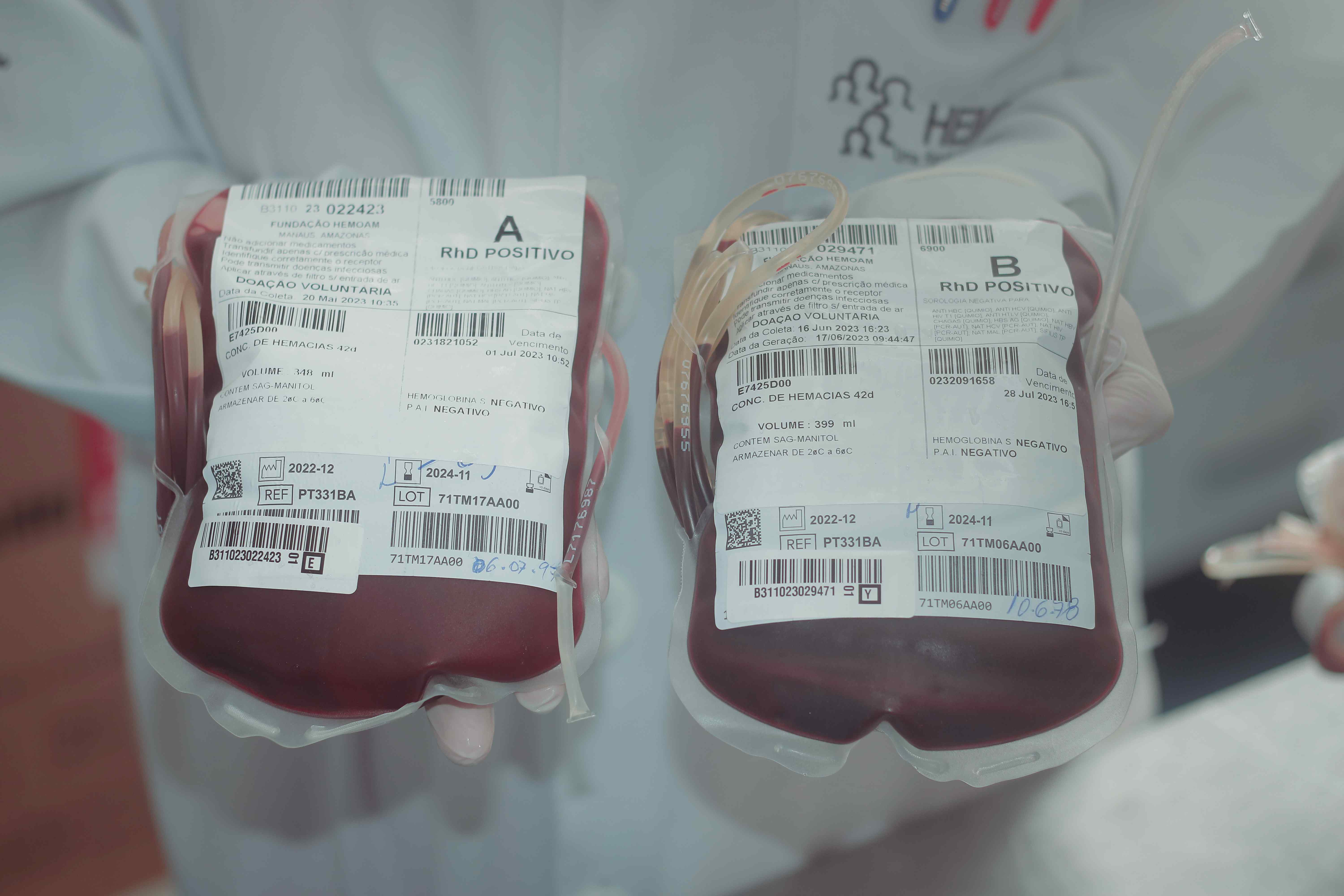 Hemoam recomenda agendamento para doadores do tipo A+ e B+ em Manaus