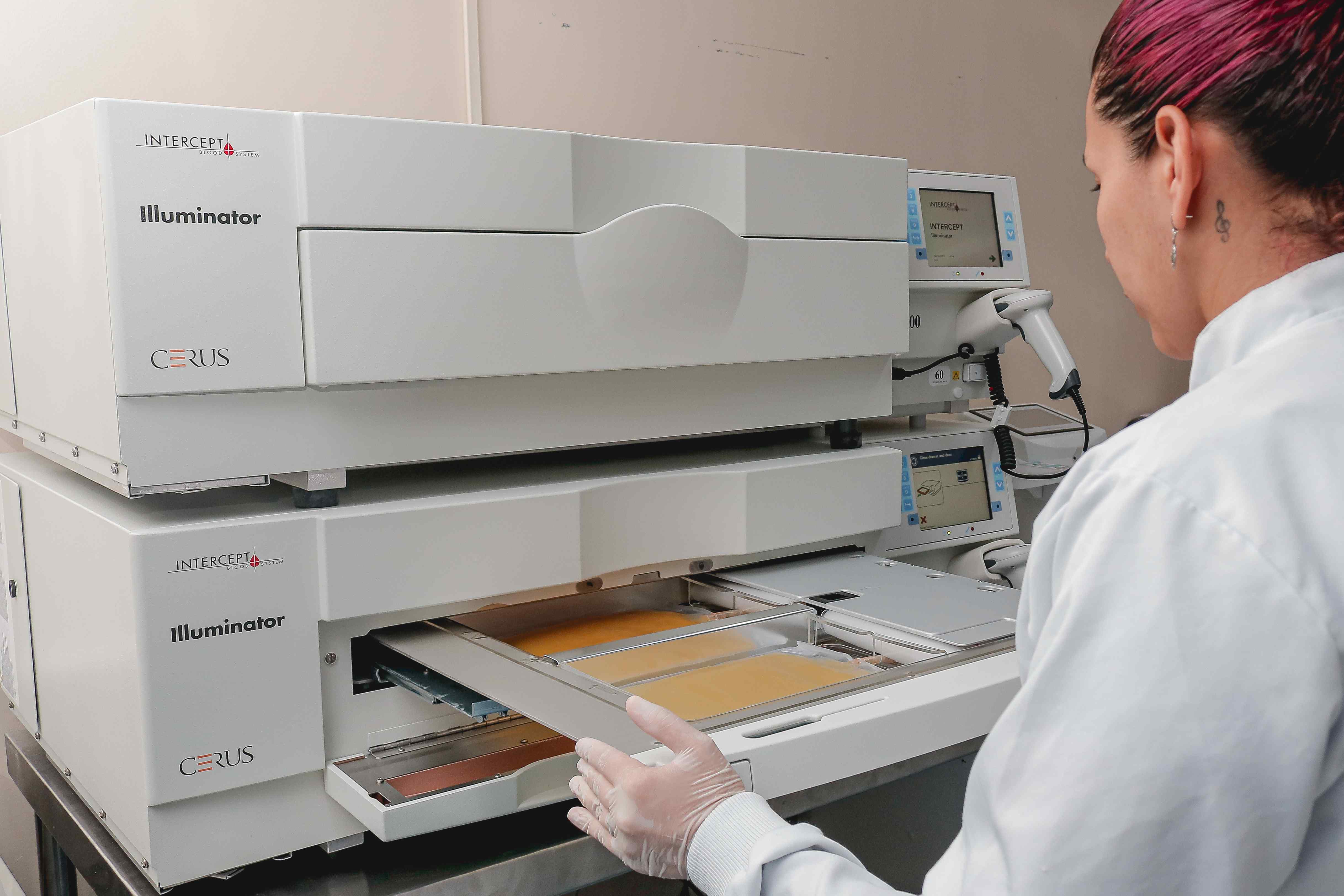 Hemoam adota tecnologia que reduz riscos de complicações pós-transfusão