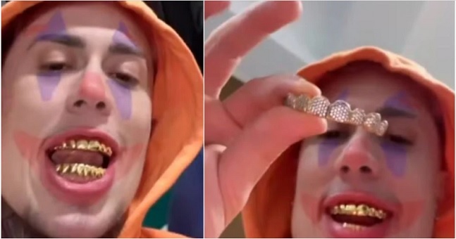 Mc Daniel exibe prótese de ouro de 18 quilates nos dentes