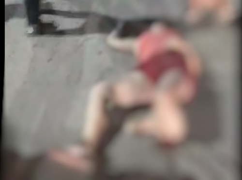 Mulher tem perna arrancada após ser atropelada por motociclista na Compensa