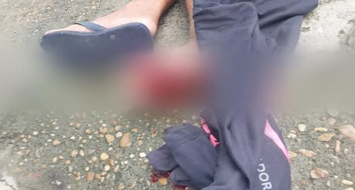 Homem perde parte do pé após pisar em catolé jogado por crianças em Manaus