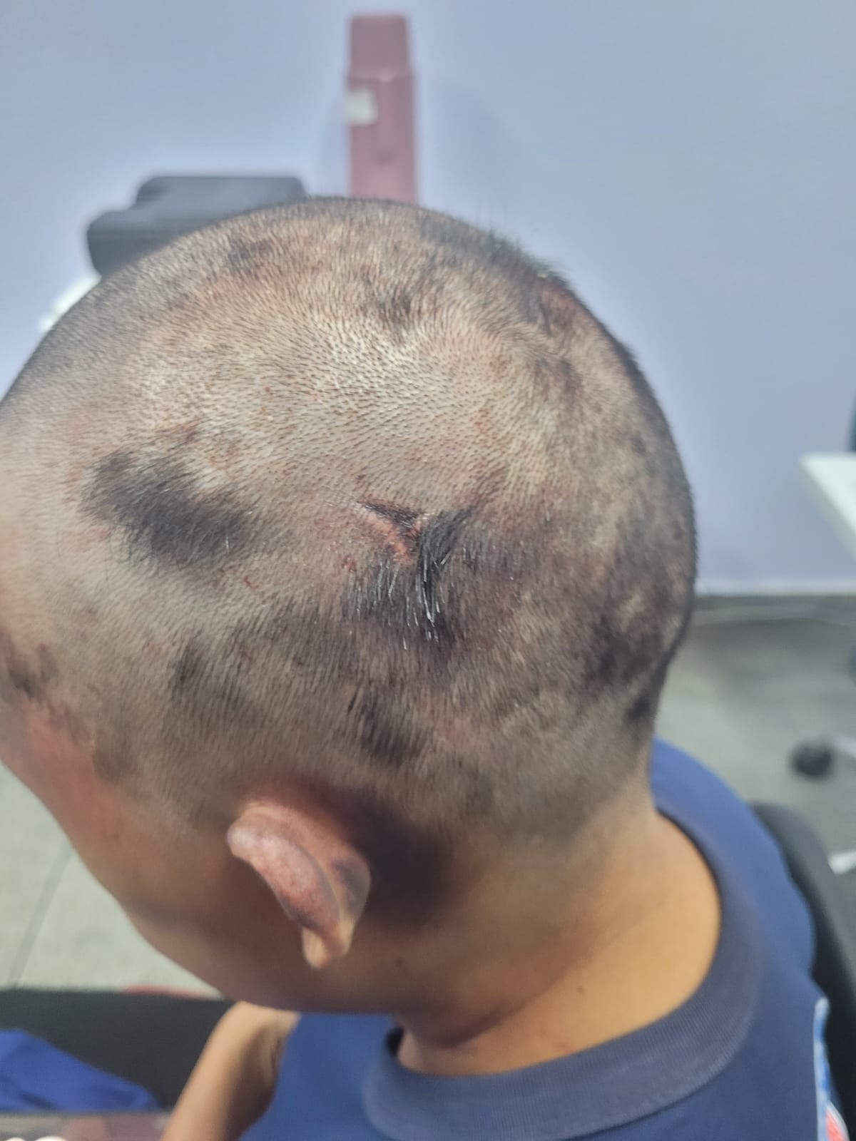 Homem é preso após torturar e raspar cabelo de ex-mulher em motel de Manaus