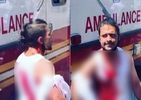 Homem choca ao caminhar tranquilamente com faca cravada na cabeça 