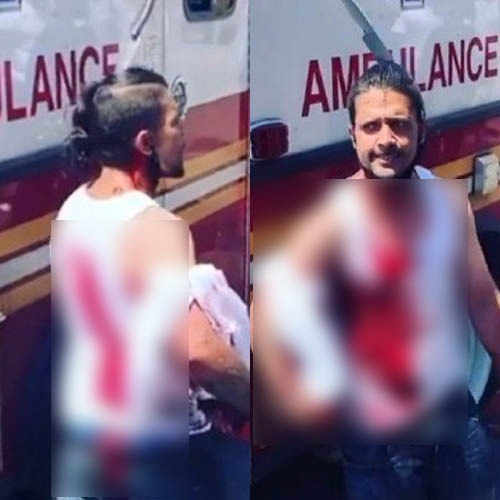 Homem choca ao caminhar tranquilamente com faca cravada na cabeça 