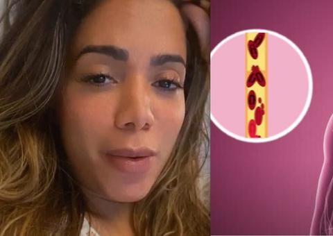 Saiba o que é trombose, doença pode levar à morte e fez Anitta ser internada