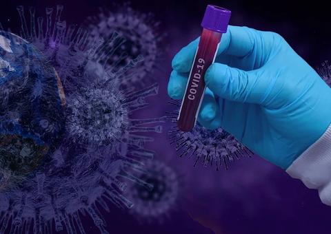 Covid-19: Brasil tem 2º dia com maior registro de novos casos