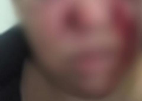 Mulher é espancada com vassouradas e tem braço quebrado por ex-marido