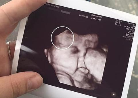 Grávida faz ultrassom e fica chocada com o que vê em bebê