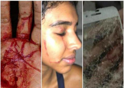 Universitária é vítima de injúrias raciais e agressão física por militar em Manaus