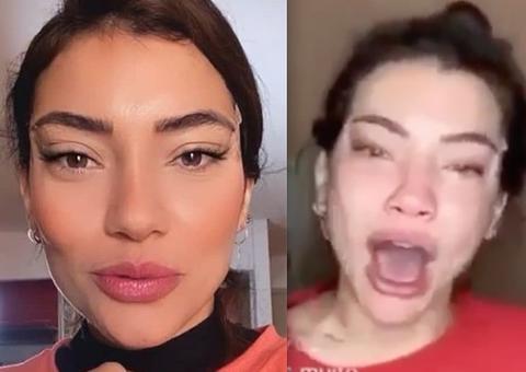 Ex-A Fazenda Gabi Prado desabafa aos prantos após ser criticada por procedimento estético