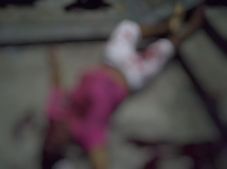 Homem é baleado e morre ao cair em escadão de beco na Compensa