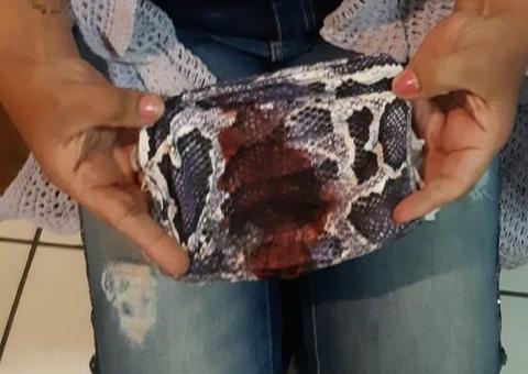 Polícia prende e Justiça solta suspeito de espancar mulher que não fez cocada