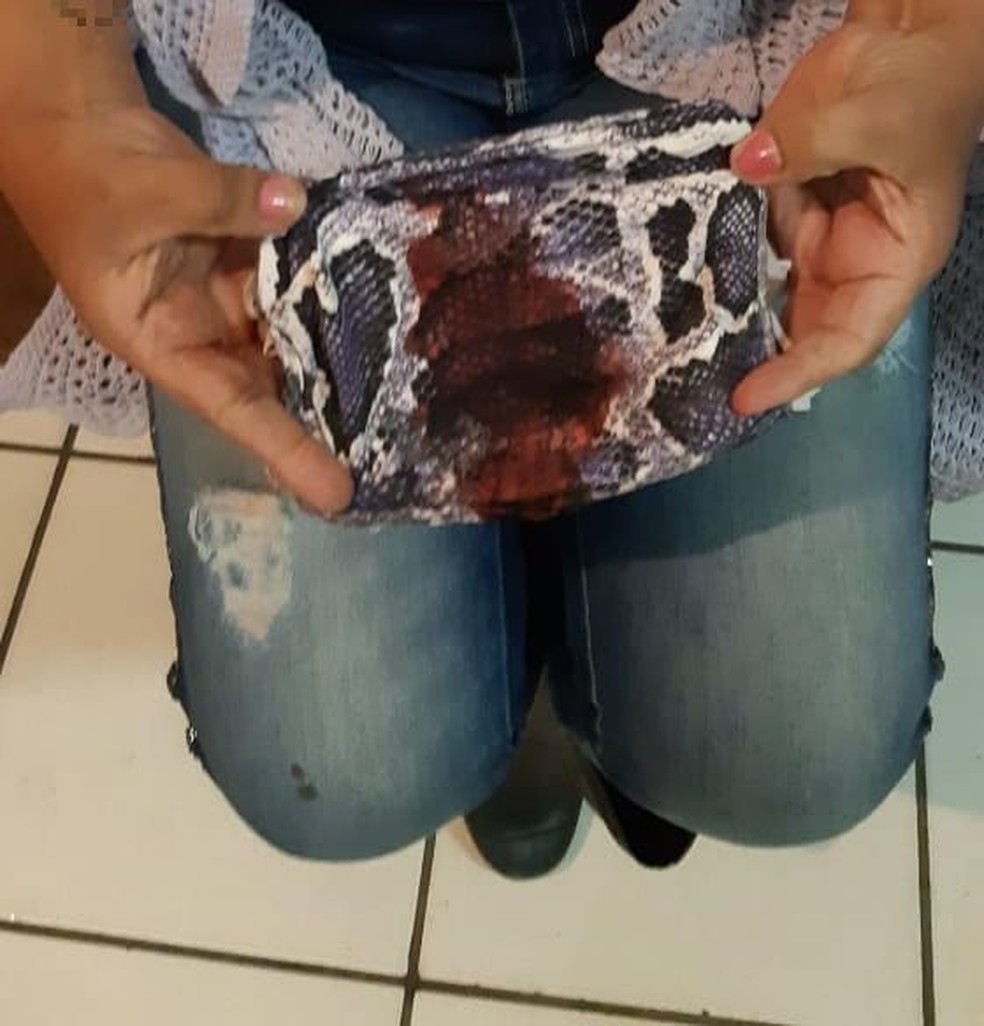 Polícia prende e Justiça solta suspeito de espancar mulher que não fez cocada