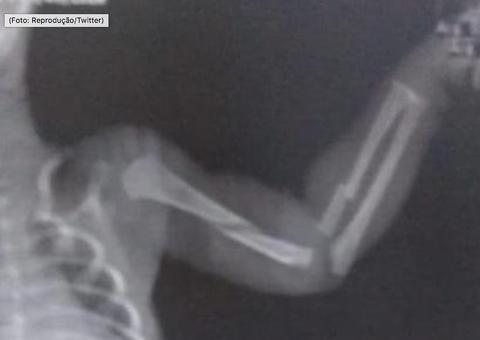 Mãe confessa que espancou bebê de dois meses e o pior acontece 