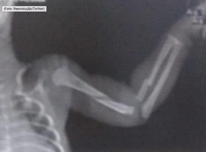 Mãe confessa que espancou bebê de dois meses e o pior acontece 