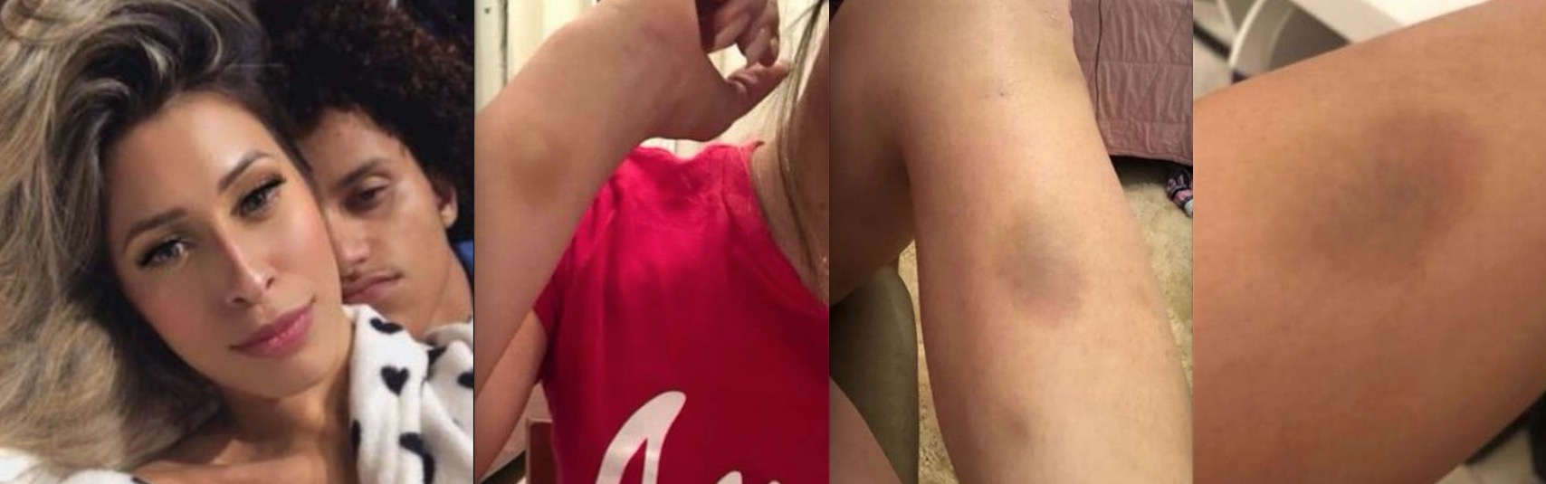 Ex de Gabriel do Borel relata que foi puxada pelos cabelos por não querer transar