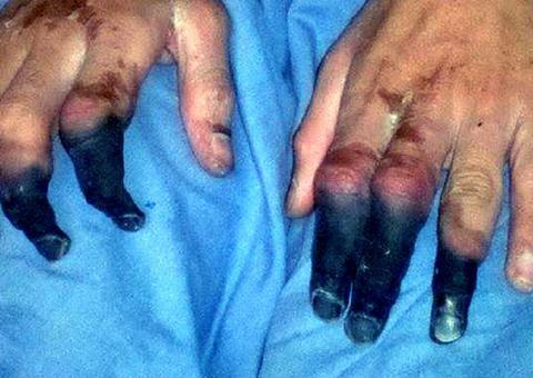 China registra novos casos de peste negra