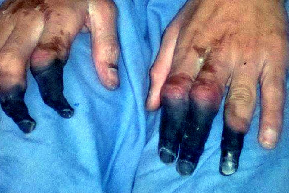 China registra novos casos de peste negra