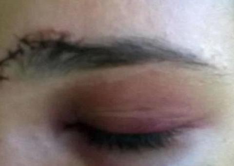 Jovem é espancada e tem cabelos arrancados ao se meter em briga de casal