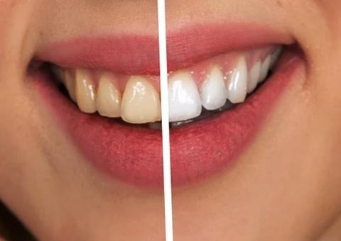 Saiba quais alimentos deixam os dentes manchados