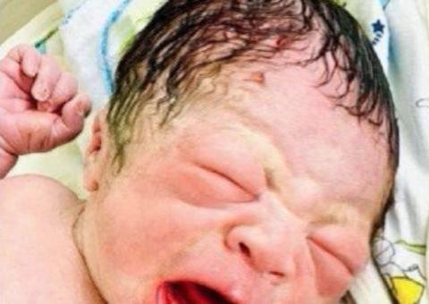 Saiba a verdade sobre o bebê que nasceu segurando um DIU