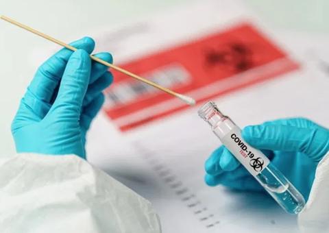 Ministros próximos a Bolsonaro também fazem teste para coronavírus