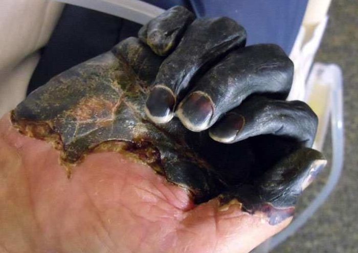 Peste Negra na China está ligada ao consumo de roedores